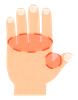 手の指